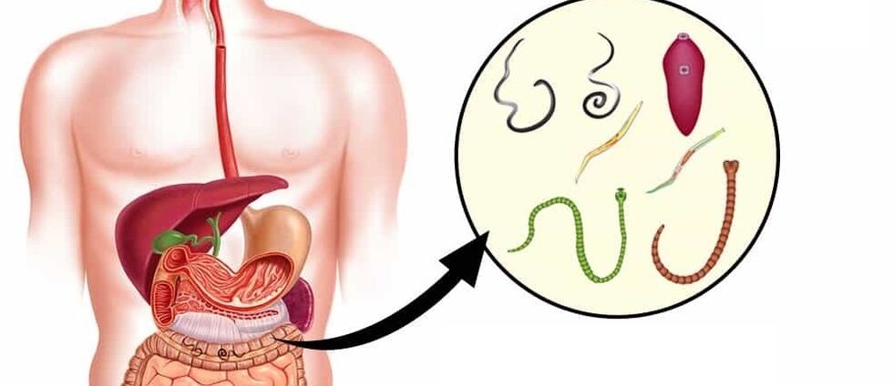 Parasites dans le corps humain
