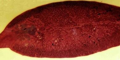 parasite trématode comment l'éliminer du corps
