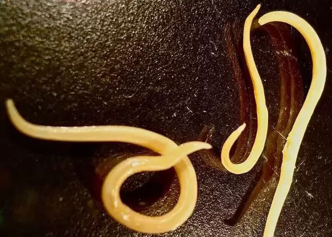 parasite protozoaire du corps humain